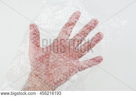 Male Hand In Plastic Wrap With Pimples. Man's Hand In A Plastic Bag. Male Hand Inside A Transparent 