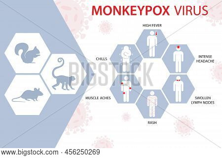 Monkey Pox Virus, Epidemic Virus, The Virus Spreads From Animals Such As Monkeys, Squirrels, Rats. S