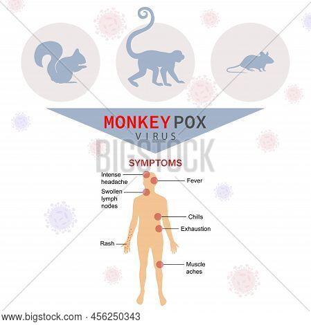 Symptoms Of The Monkey Pox Virus. The Epidemic Virus Spreads From Animals Such As Monkeys, Squirrels