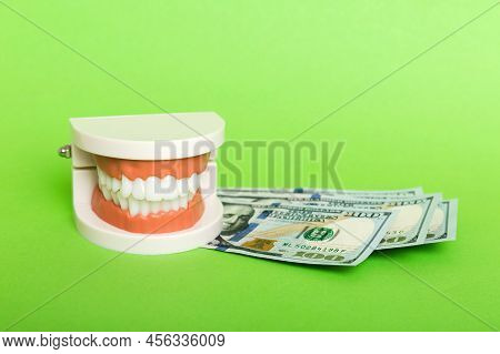 Closeup Model Of A Human Jaw With White Teeth And Dollar Bill. Dentistry Conceptual Photo. Prostheti