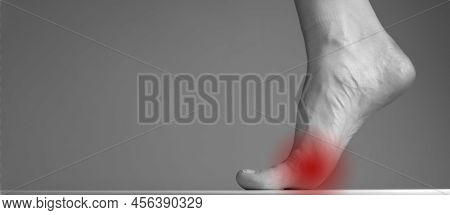 Foot Neuroma, Toe Ache, Inflammation On Medical Banner With Copy Space. High Quality Photo