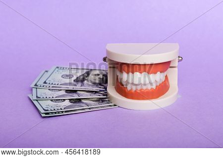 Closeup Model Of A Human Jaw With White Teeth And Dollar Bill. Dentistry Conceptual Photo. Prostheti