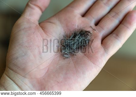 Short Hair Lies In The Open Palm Of A Man's Hand.  The Persona Holds Brown Hair With Gray In His Han