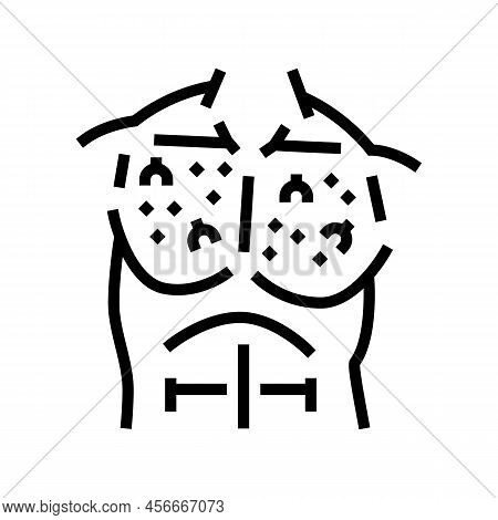 Chest Ingrown Hair Line Icon Vector. Chest Ingrown Hair Sign. Isolated Contour Symbol Black Illustra