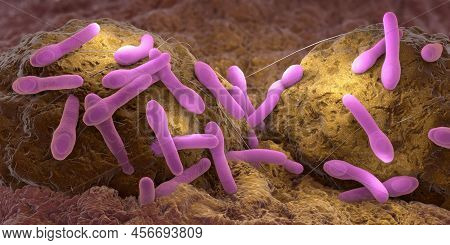 Clostridium Botulism Pathogens Growing On Organic Tissue - 3d Illustration