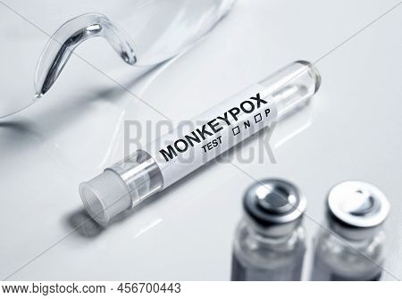 Monkey Pox Test Tube In Lab, On White Medical Desk. Equipment For Monkeypox Virus Diagnosis And Smal