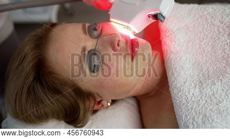 Hifu Treatment On Female Face. High Intensity Focused Ultrasound. Anti Aging Treatment And Plastic S