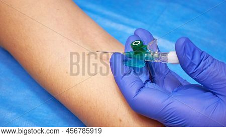 Preparation For Venous Catheterization. Intravenous Catheter In Doctor's Hands