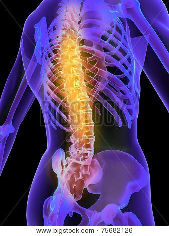 backache illustration