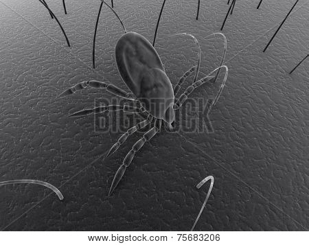 tick bite