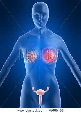 painful breast