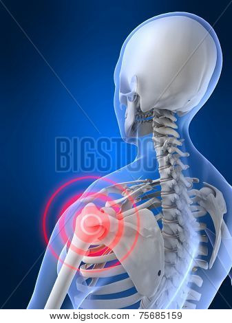 painful shoulder