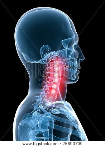 neck pain