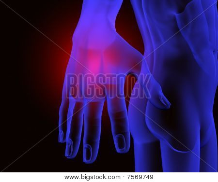 Radiografia mies Mano