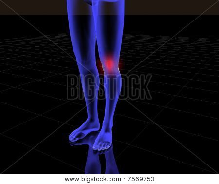 Radiografia mies Rodilla