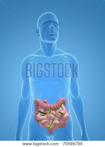 small intestines infection