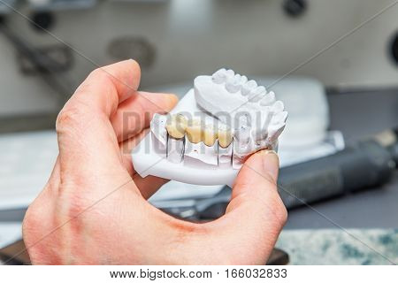 Technical shots of model on a dental prothetic laboratory.Dentist hand with plaster model and ceramic dentures