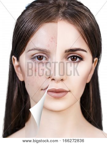 Layer with bad skin unstick from good healthy skin.