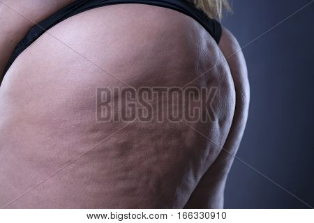 Fat female body with cellulite fatty hips and buttocks on gray background side view