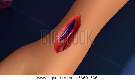 Most veins carry deoxygenated blood from the tissues back to the heart; exceptions are the pulmonary and umbilical veins, both of which carry oxygenated blood to the heart. In contrast to veins, arteries carry blood away from the heart. Veins are less mus