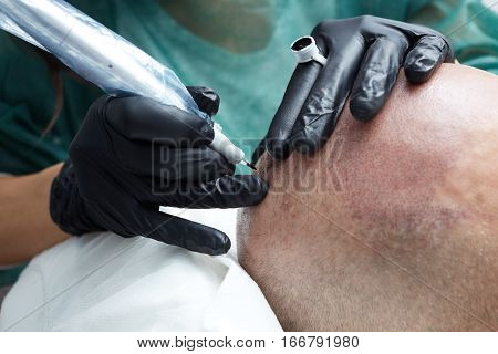 Cosmetologist making permanent makeup on male skin head - tricopigmentation applying