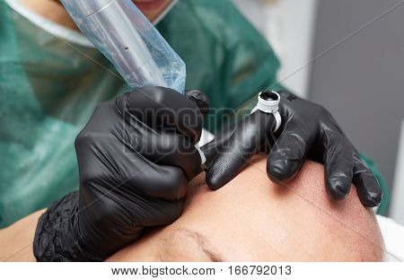 Cosmetologist making permanent makeup on male skin head - tricopigmentation applying