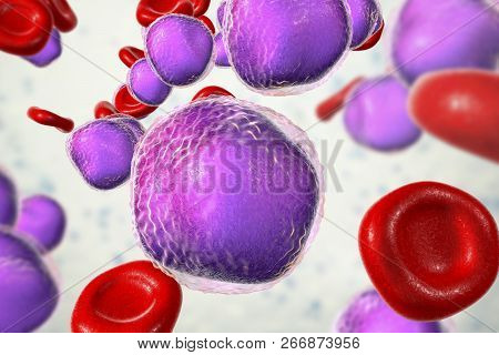 Acute Lymphoblastic Leukemia, Bone Marrow Smear, 3d Illustration