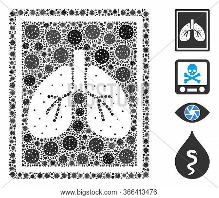 Mosaic Lungs Fluorography Designed From Coronavirus Icons In Various Sizes And Color Hues. Vector Vi