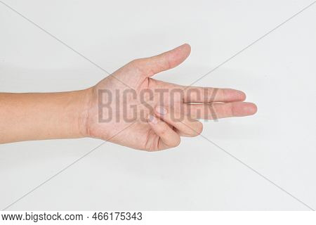 Unilateral Dupuytren's Contracture In Asian Young Man.