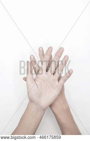 Pale Palmar Surface Of Both Hands. Anaemic Hands Of Asian, Chinese Man. Isolated On White Background