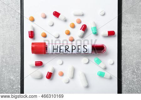 Test Tube With Word Herpes Different Pills And Clipboard On Light Grey Table, Flat Lay