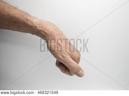 Hand Muscle Rigidity And Finger Flexion Of Asian Elder Man.