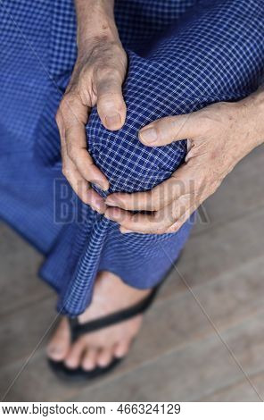 Knee Joint Pain In Asian Myanmar Elder Man. Concept Of Osteoarthritis, Rheumatoid Arthritis, Patella