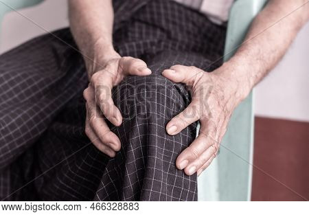 Knee Joint Pain In Asian Myanmar Elder Man. Concept Of Osteoarthritis, Rheumatoid Arthritis, Patella