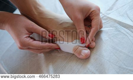 Treatment And Prevention Of Hallux Valgus. Woman Applies Valgus Splint, Silicone Finger Spacer Close