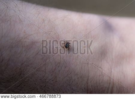 Ixodoidea Mite Crawls On Human Skin Close Up.