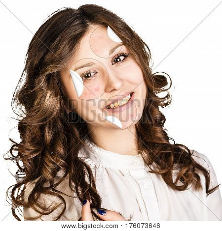 Circles layers of skin with acne unstick from good healthy skin of young woman.