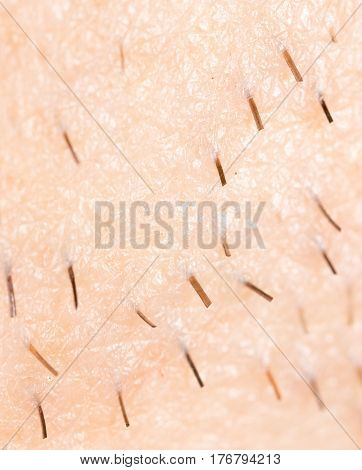the bristles on the skin . Photo texture