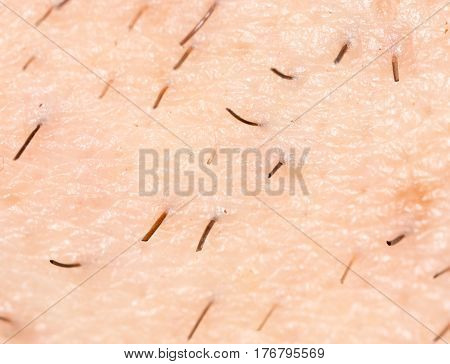the bristles on the skin . Photo texture