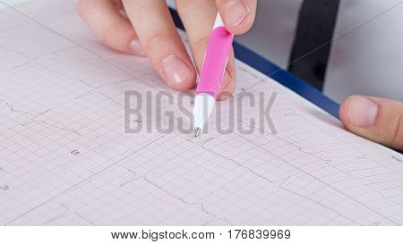 Electrocardiogram in the hands of doctor with pen.