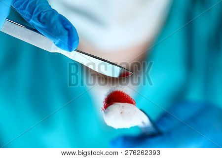 Surgeon In Sterile Uniform Arms Holding And Passing To Colleague Tools With Bio Material Wad Closeup