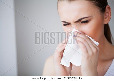 Flu And Sick Woman. Sick Woman Using Paper Tissue, Head Cold Problem
