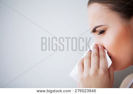 Flu And Sick Woman. Sick Woman Using Paper Tissue, Head Cold Problem