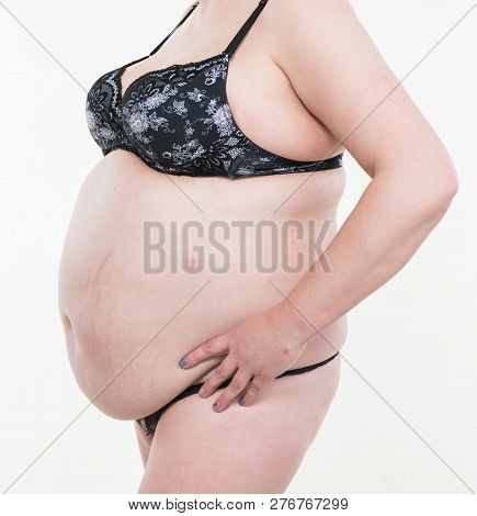 Close Up Of Woman With Fat Abdomen, Overweight Female Stomach, Stretch Marks On Belly. Big Belly Is