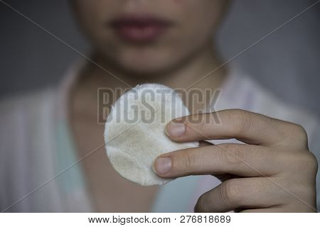Inflammation And Cleansing Of Oily Teenage Skin On The Face