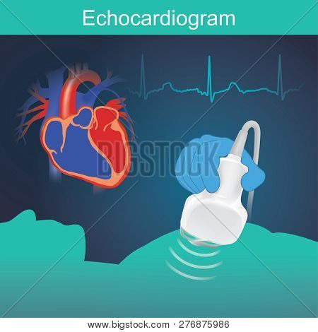 Heart Examination With High Frequency Sound Waves Very Useful In Evaluating Heart Function, Includin