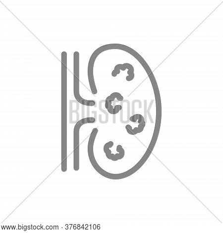 Kidney With Tumors Line Icon. Renal Cell Carcinoma, Organ For Filtering Blood Disease Symbol