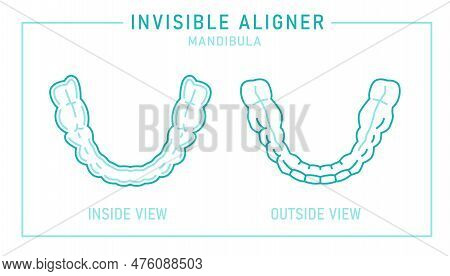 Orthodontic Silicone Trainer. Invisible Braces Aligner, Retainer.