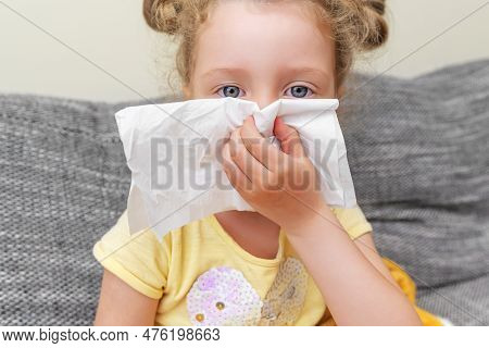 The Child Has A Cold. He Wipes His Nose With A Tissue. Strong Runny Nose.