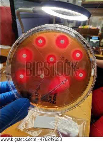 Streptococcal Bacterial Colonies On Blood Agar Culture Plates